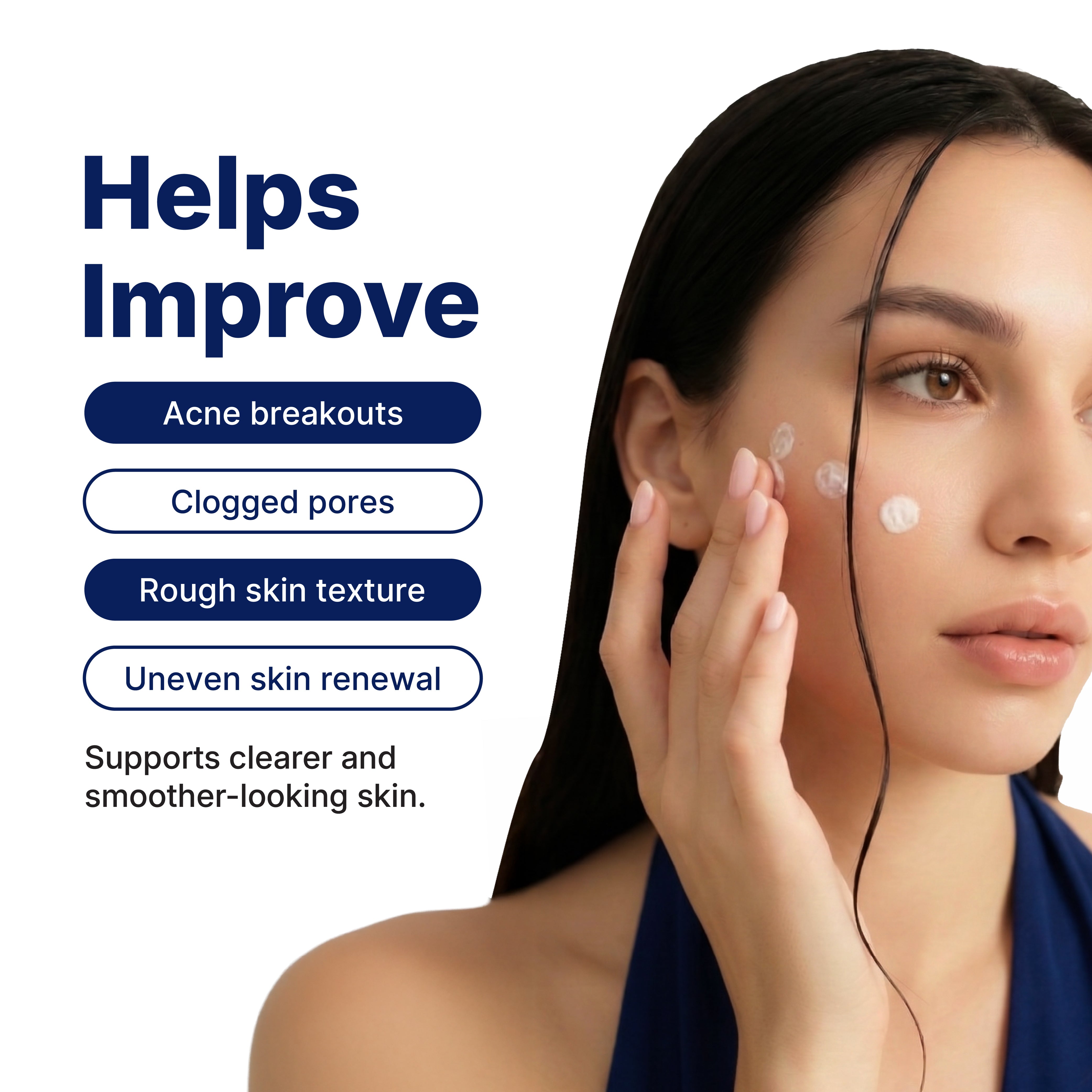 Before — visible breakouts, applying ACNETECH